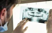 Cancer and Dental Health