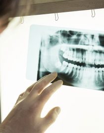 How Does Cancer Affect Your Dental Health? How Does Cancer Affect Your Dental Health?