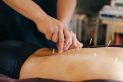 Acupuncture for Liver Cancer
