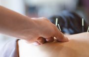 Acupuncture for Ovarian Cancer