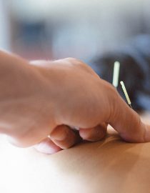 What Are the Benefits of Acupuncture for Ovarian Cancer Patients? What Are the Benefits of Acupuncture for Ovarian Cancer Patients?