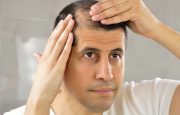 Liver Cancer and Hair Loss