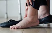 Liver Cancer and Edema