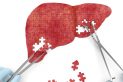 Liver Cancer Causes