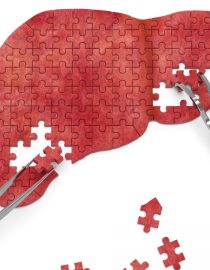 Pinpointing What Causes Liver Cancer for Better Prevention Pinpointing What Causes Liver Cancer for Better Prevention