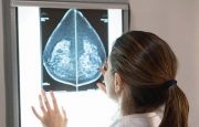 stage 4 breast cancer