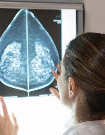 What You Need to Know About Stage 4 Breast Cancer What You Need to Know About Stage 4 Breast Cancer